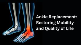 Ankle Replacement: Restoring Mobili...