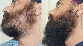Explain The Significance of Beard H...