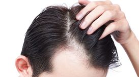 How to Choose Hair Transplant Surge...