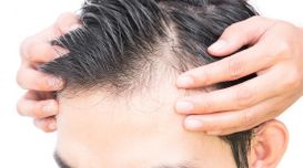 Suffering From Hair Loss? How Hair ...