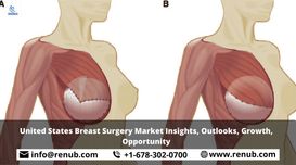 United States Breast Surgery Market...