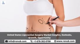 United States Liposuction Surgery M...