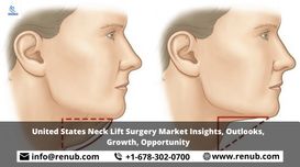 United States Neck Lift Surgery Mar...