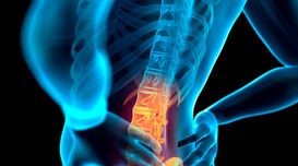 What Is A Spinal Implant And Who Ca...